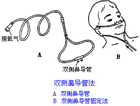 ◆肺病患者如何家庭氧療？